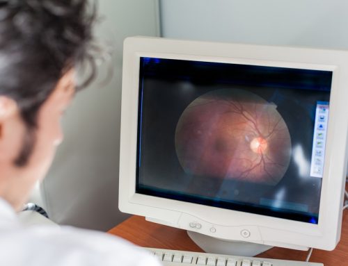 What Is the Treatment for Retinal Vein Occlusion?