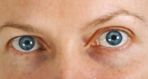 uveitis treatment eye center bergenfield nj