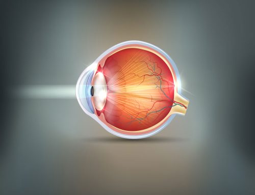 When To Have Cataract Surgery